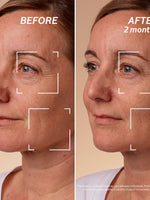 蠟菊賦活極萃霜